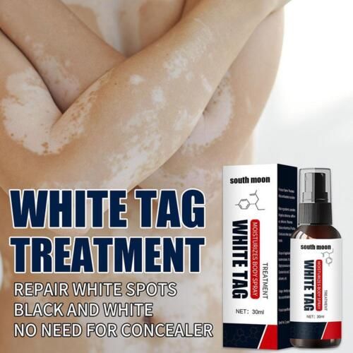 South Moon White Tag Treatment Moisturizing Body Spray | মুন চাঁদ ট্রিটমেন্ট বডি স্প্রে
