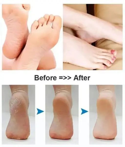 Rechargeable Pedicure Machine – Foot &amp; Heel Care Device with 2 Roller Heads for Smooth, Soft Feet | রিচার্জেবল মেশিন ফুট পা কেয়ার ডিভাইস রোলার Specification 9