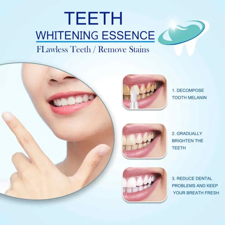 Mintsincerely ™ Teeth Whitening Pens | দাঁত হোয়াইটেনিং Specification 4