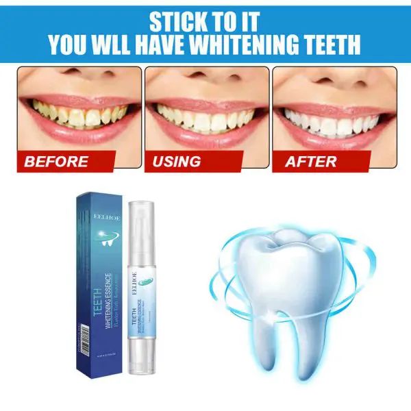 Mintsincerely ™ Teeth Whitening Pens | দাঁত হোয়াইটেনিং Specification 5
