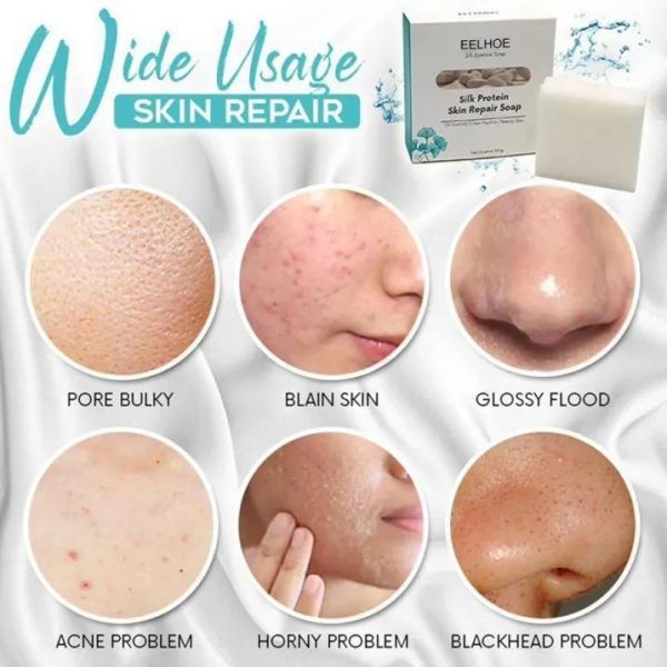 EELHOE Silk Protein Skin Repair Soap | স্কিন ত্বক রিপেয়ার সাবান Specification 1