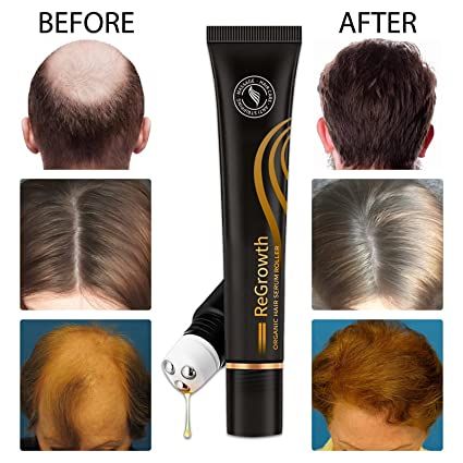 Regrowth Hair Serum | হেয়ার চুল সিরাম Specification 4
